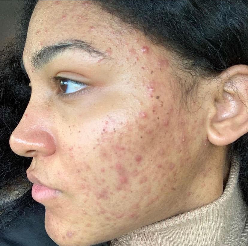 Vegan Antioxidant Facial Moisturizer.